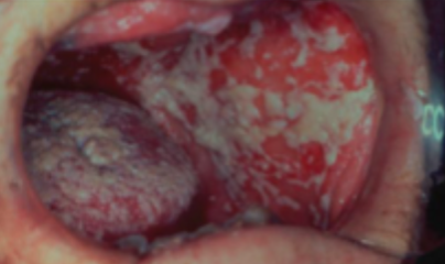 <p>what is this condition  </p>