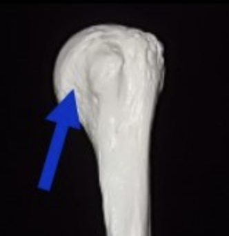<p>Anatomical neck (humerus proximal end) </p>