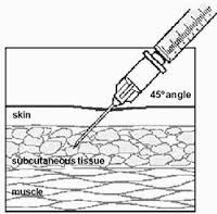 <p>Drug delivered in fat layer of the skin. Needle is 45 degree angle to the skin</p>