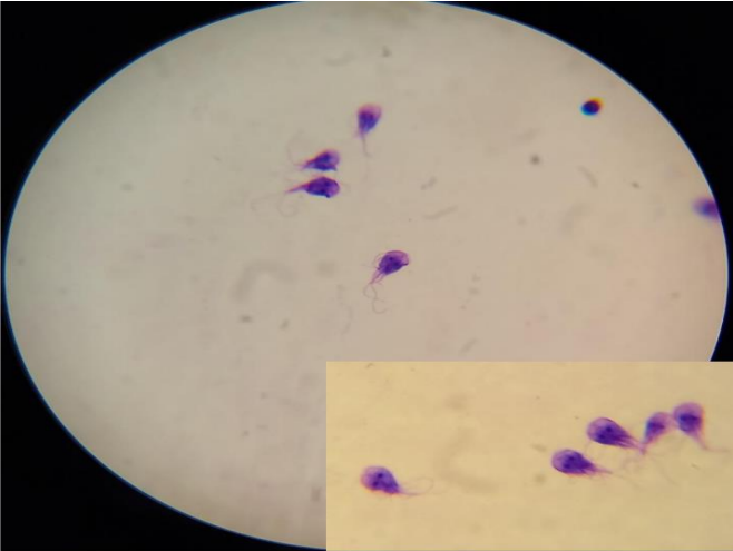 <p>Identifique e indique o habitat desse protozoário</p>