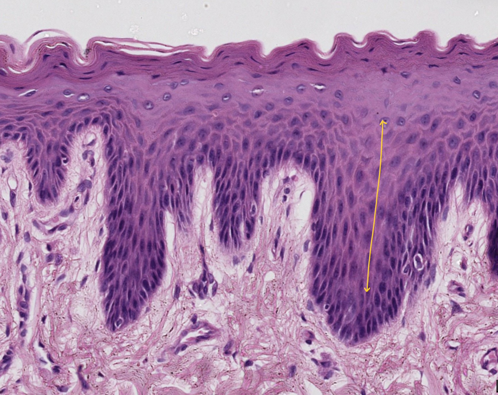 <p>multiple layers of polygonal cells</p>