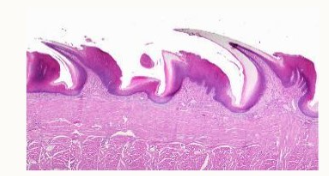 <p>what papillae are these?</p>