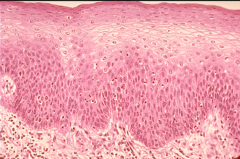 <p>Description: thick membrane composed of several cell layers</p><p>Function: protects underlying tissues in areas subjected to abrasion</p><p>Location: esophagus, mouth and vagina.</p>