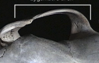 <p>The _______ _______ is where the Squamosal and Jugal meet)</p>