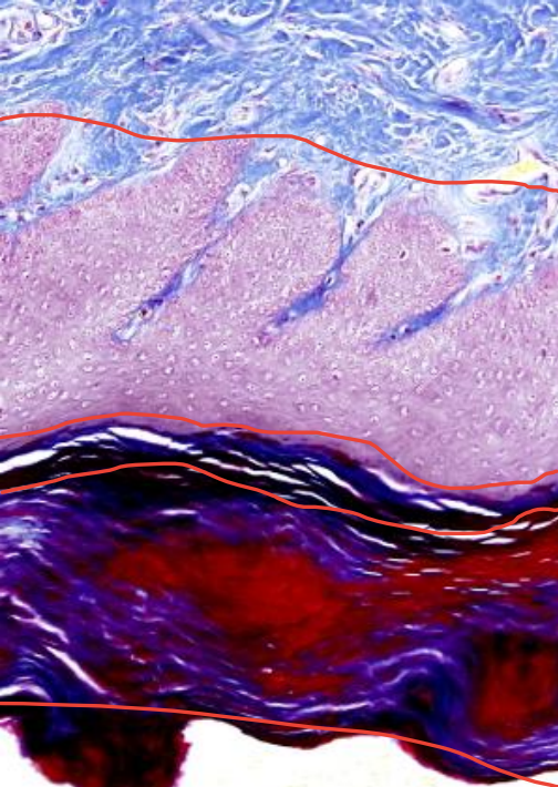 <p>Name the layers top to bottom?</p>