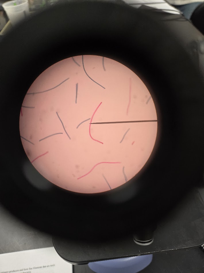 <ol><li><p>what is the phylum of this bacteria?</p></li><li><p>gram positive or gram negative?</p></li></ol><p></p>