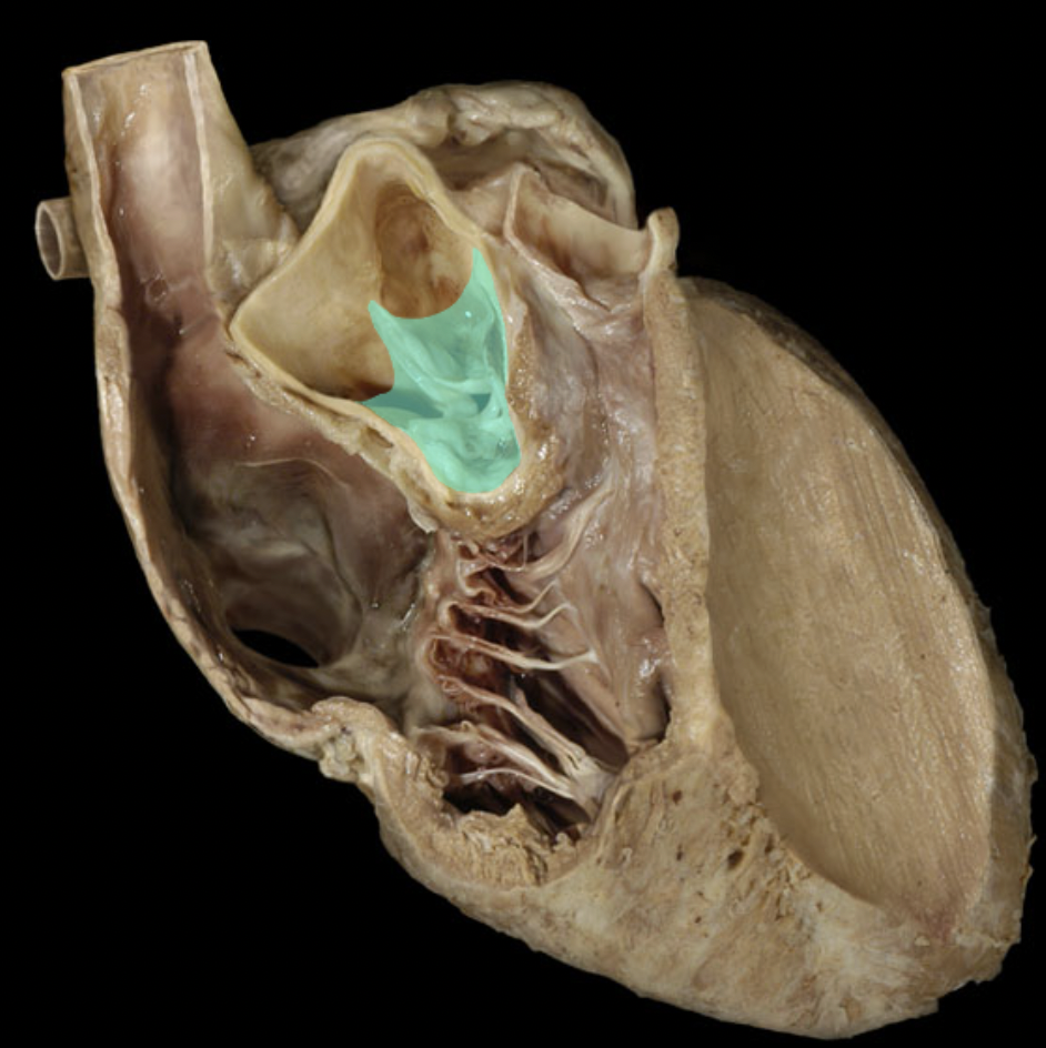 <p>Identify the feature of the left ventricle</p>