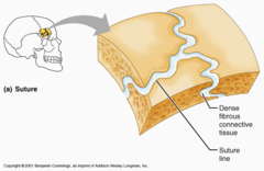<p>Bones joined by fibrous tissue; no joint cavity; mostly immovable. (Synarthrosis)</p>