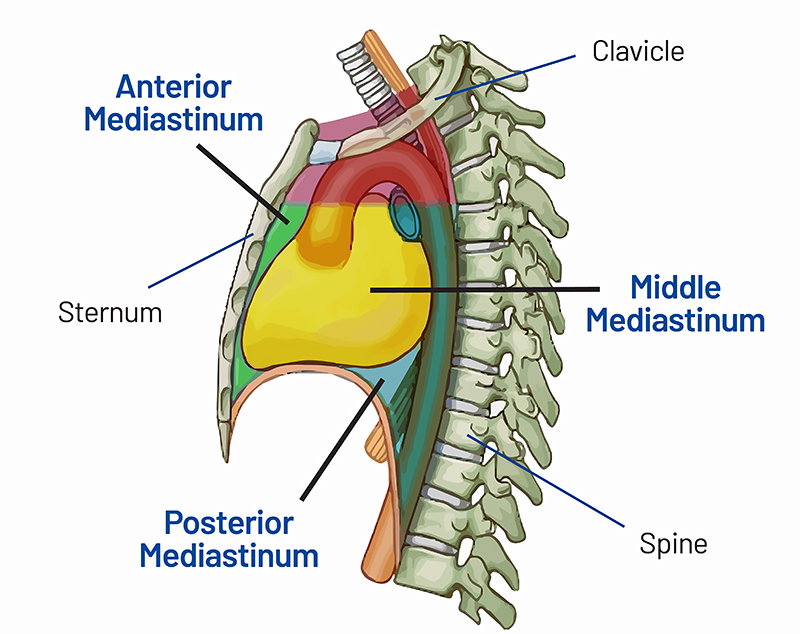 <p>horizontal plane</p><p>passes thorugh sternal angle+IVD between T4-T5</p><p><u>superior mediastinum (red)</u></p><ul><li><p>large vessels of heart</p></li><li><p>trachea</p></li></ul><p><u>inferior mediastinum</u></p><p><strong>subdivided by pericardium:</strong></p><p><u>anterior mediastinum (green)</u></p><ul><li><p>between sternum+pericardium</p></li></ul><p><u>middle mediastinum (yellow)</u></p><ul><li><p>pericarium</p></li><li><p>heart</p></li></ul><p><u>posterior mediastinum (blue)</u></p><ul><li><p>between pericaridum+thoracic vertebrae</p></li></ul><p></p>