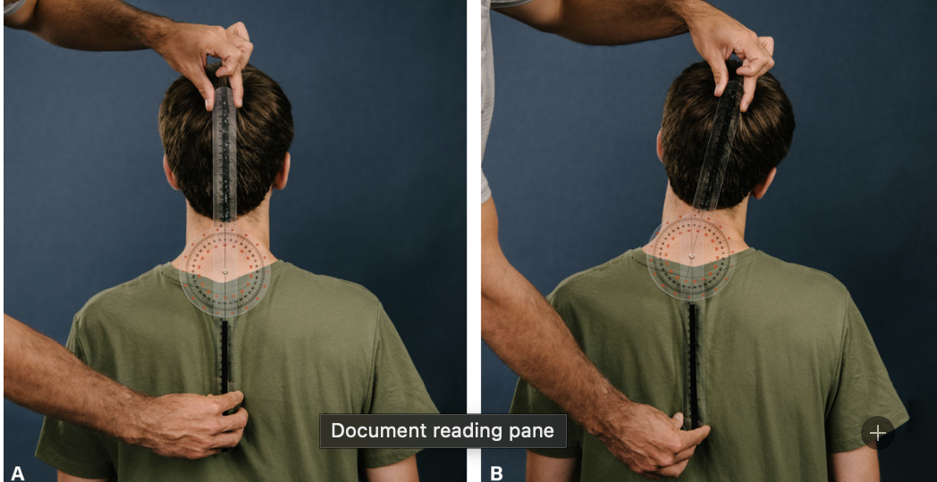 <p>Neck Lateral Flexion</p>