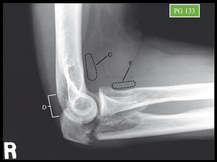 <p>E</p>