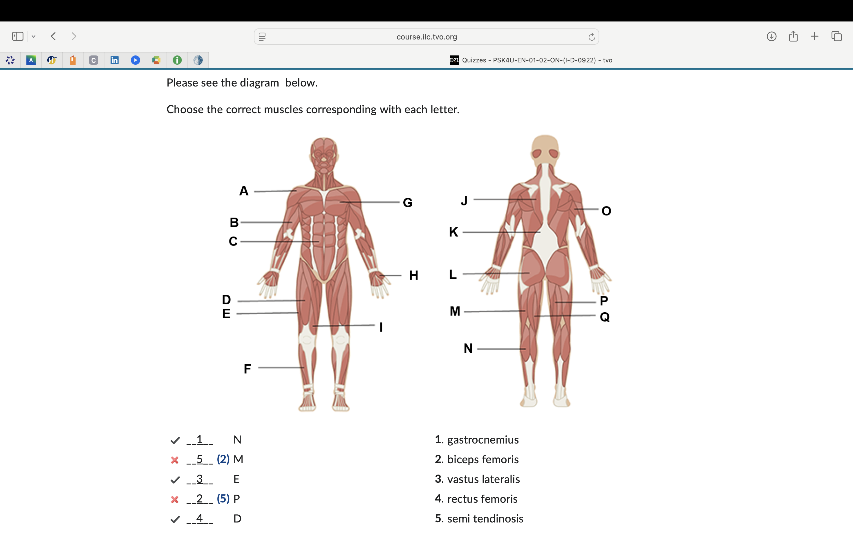 <p>correct muscles:</p>