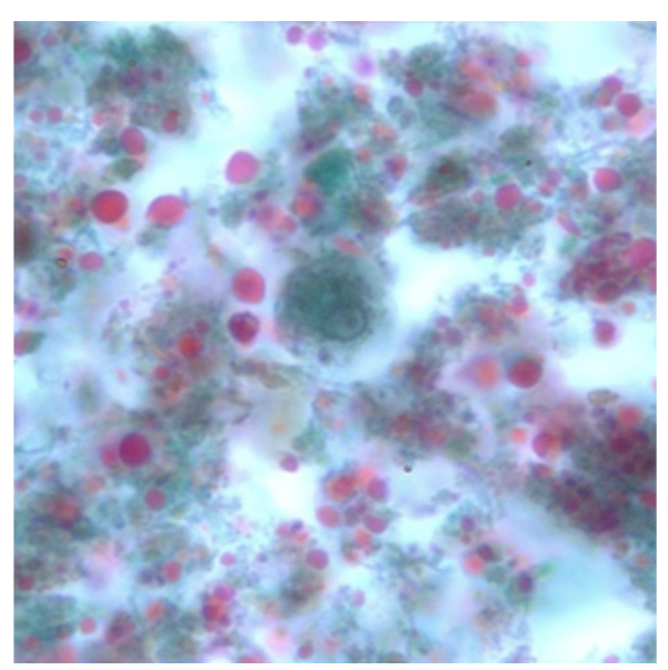 <p>-Looks like a miniature E. histolytica</p><p>-Up to 4 nuclei</p>