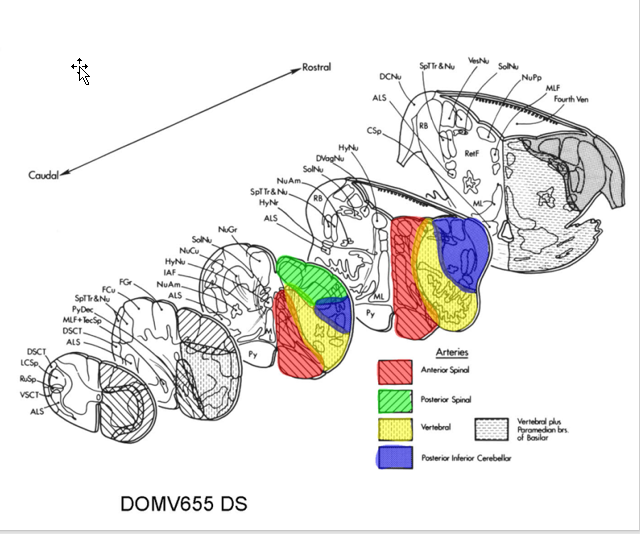 <p>anterior spinal artery </p><ul><li><p>Medial/Ventral</p></li></ul><p>Vertebral Artery</p><ul><li><p>Intermediate lateral Area</p></li></ul><p>posterior spinal artery </p><ul><li><p>Dorsal (caudal) Region </p></li></ul><p>Posterior inferior cerebellar artery</p><ul><li><p>Dorsolateral</p></li></ul><p></p>