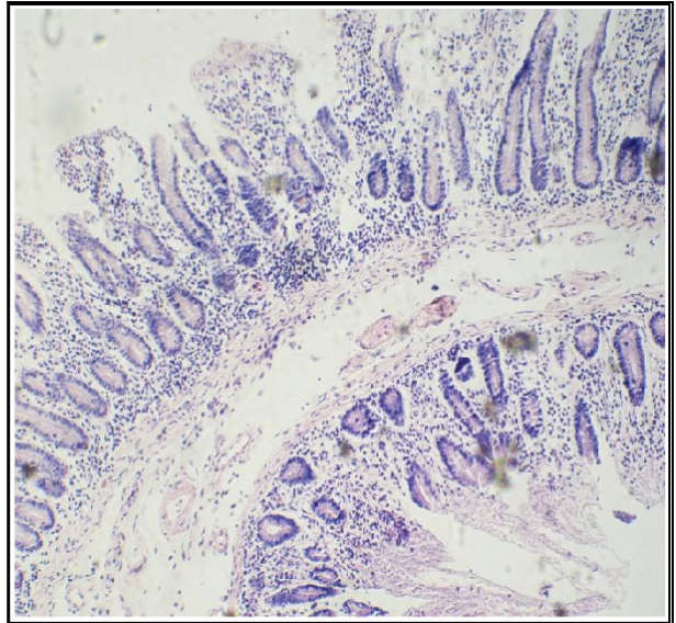 <p>What is the cell surface specialization present in this organ?</p>