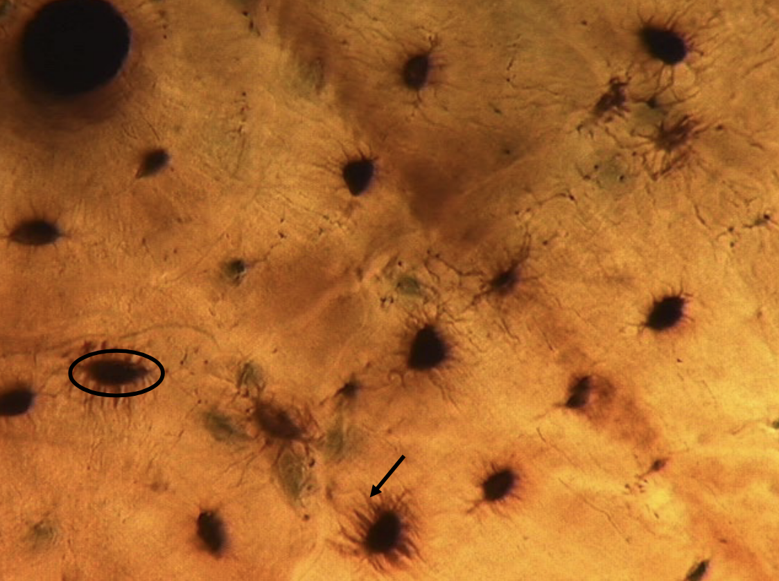 <ol><li><p><span>Concentric rings of ________ (black circle) are arranged in successive rings around the central canals.</span></p></li><li><p>Osteocytes live in these lacunae, and they interconnect with surrounding osteocytes via small channels called ________ (black arrowed line), which microscopically resemble fine hairs.</p></li></ol><p></p>