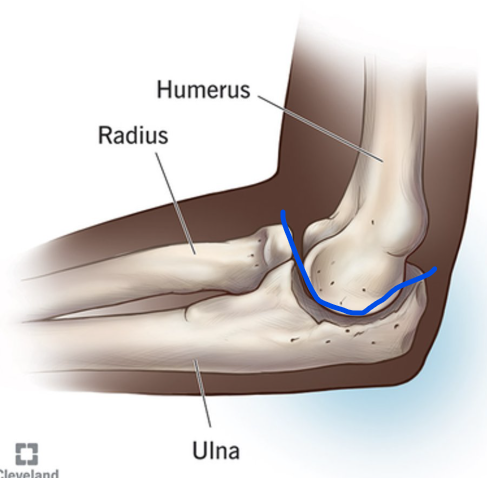 <p>What is this joint?</p>