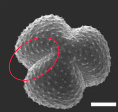 <p>Identify the circled aperture</p>