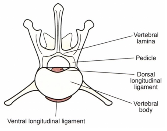 <p><u>Vertebra:</u></p><ul><li><p><strong>Vertebral lamina</strong> = Roof of the vertebral canal</p></li><li><p><strong>Intervertebral foramen</strong> = Hole between two adjacent vertebrae to allow nerves to pass from the spinal cord</p></li><li><p><strong>Pedicles</strong> = Help encase the spinal cord and acts as a bridge between the vertebral body and the rest of the vertebra</p></li></ul><p><u>Intervertebral Disc:</u> Fibrocartilaginous disc between bodies of each pair of vertebrae to act as shock absorber and prevent damage to the spinal cord during movement</p><ul><li><p><strong>Annulus fibrosus</strong> = Outer area of tough fibrous connective tissue (concentric rings of collagen)</p></li><li><p><strong>Nucleus pulposus</strong> = Inner core of gelatinous material</p></li></ul><p></p>