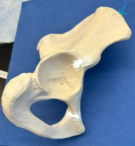 <p>ID Os Coxae feature</p>