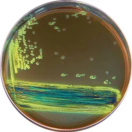 <p>eosin methylene blue agar (emb)</p>