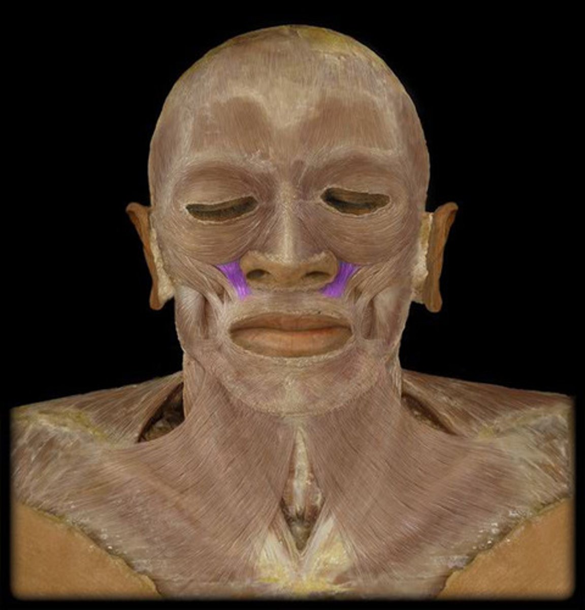 <p>Region:</p><p>Face</p><p>Action: </p><p>Elevates upper lip </p><p>Innervation: </p><p>CN VII </p>