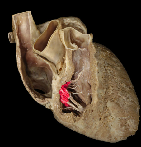term image