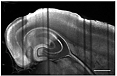 <p><strong>striping artifacts</strong></p><ol><li><p><span>&nbsp;sample features that scatter, absorb, or otherwise perturb the incident beam upstream result in weaker downstream illumination, visible as dark “stripes”.</span></p><ul><li><p><span>Change in beam intensity the deeper it travels through the tissue</span></p></li><li><p><span>Corrected by modulating the light or post image processing</span></p></li></ul></li></ol><p></p>