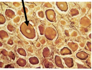 <p>Dorsal Root Ganglion</p>