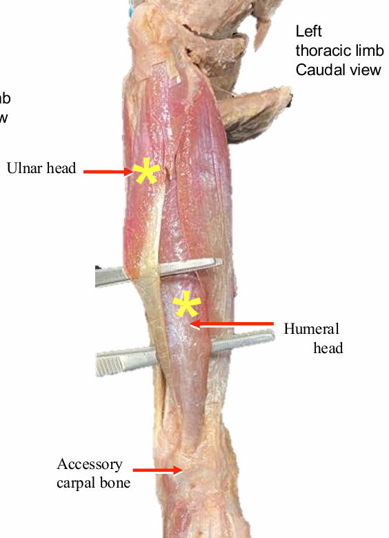 <p>Flexor carpi ulnaris m.</p>