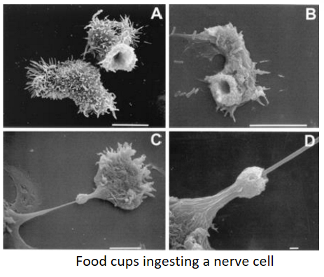 <p>Describe the <strong>Life Cycle</strong> of this waterborne protozoan:</p><p>-<strong>Acanthamoeba</strong></p>