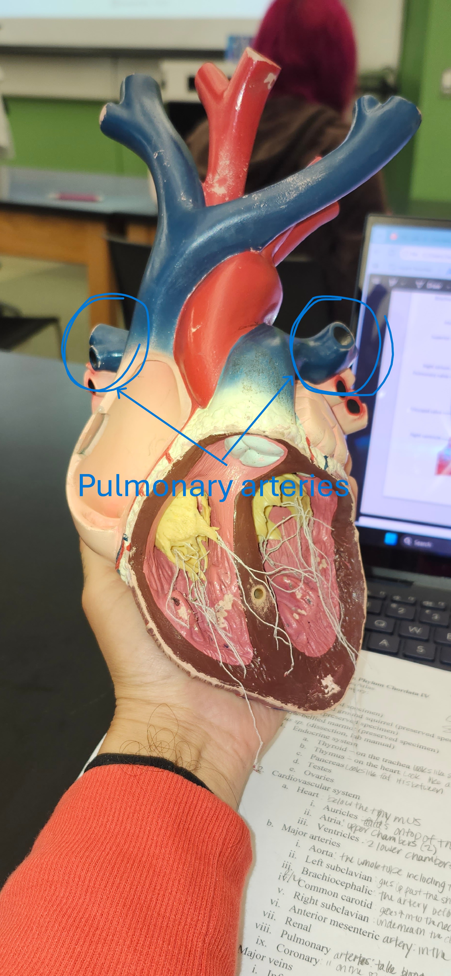 <p>pulmonary arteries</p>