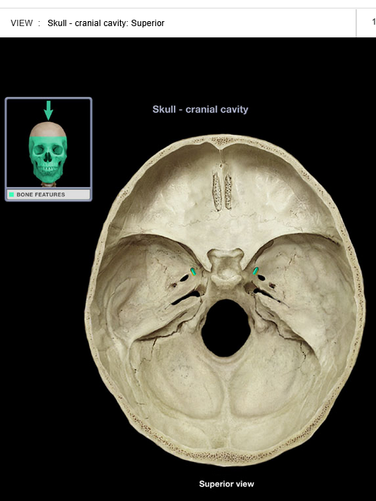 <p>Foramen rotundum</p>