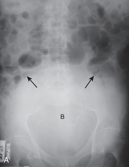 <p>diagnosis</p>