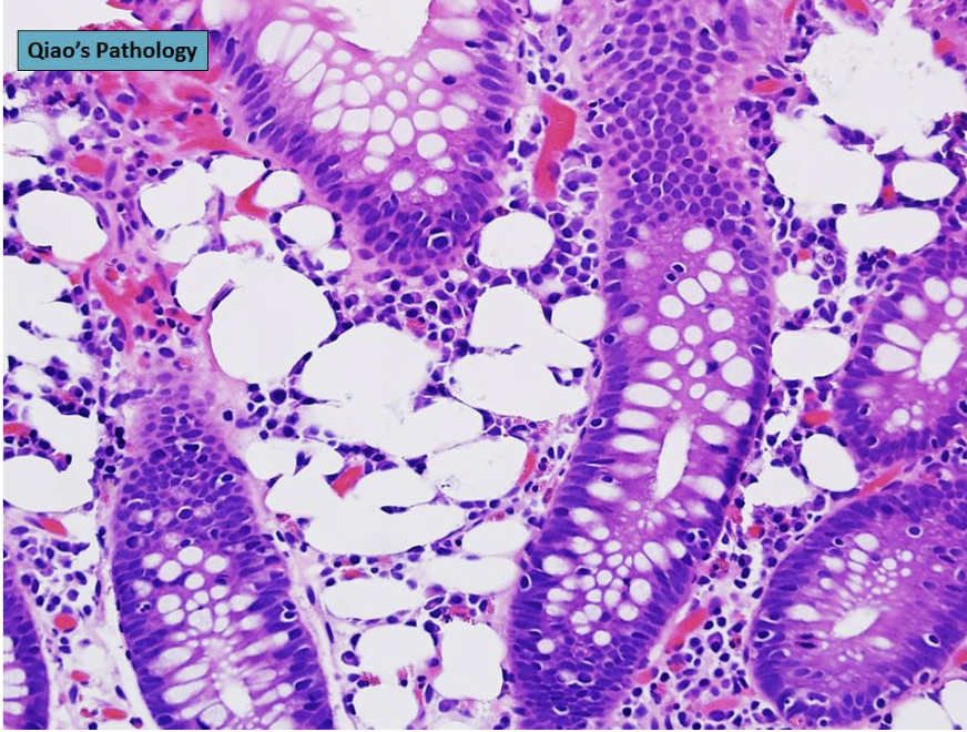 <p>1) Diagnostic</p><p>2) Origine</p>