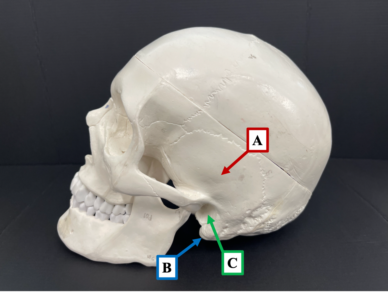 <p>Which part of the temporal bone is label <strong>B </strong>pointing to?</p>