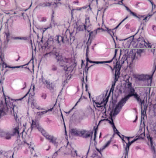 <p>What type of cartilage is this?</p>