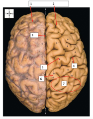 <p>#2</p>