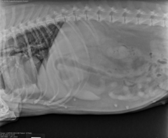 <p>Ascites?</p>