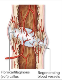<p>Calluses stabilize the break</p>