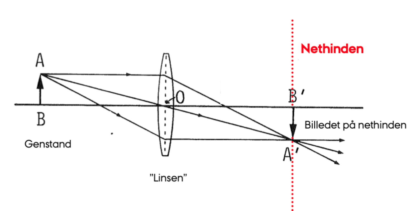 <p>Fordi <strong>a ændrer sig</strong>, mens <strong>b, afstanden til retina, næsten er fast</strong>.</p>