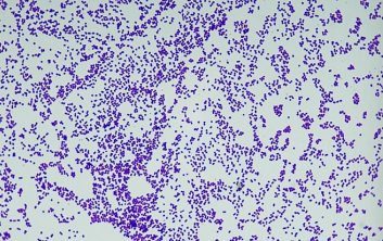 <p>gram positive or negative </p>