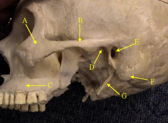 <p>Identify structure labelled E.</p>