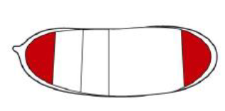 <p>required for patterning anterior and posterior extremities</p>