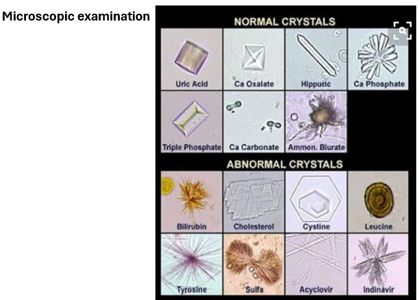 <p>microscopic examination of urine</p>