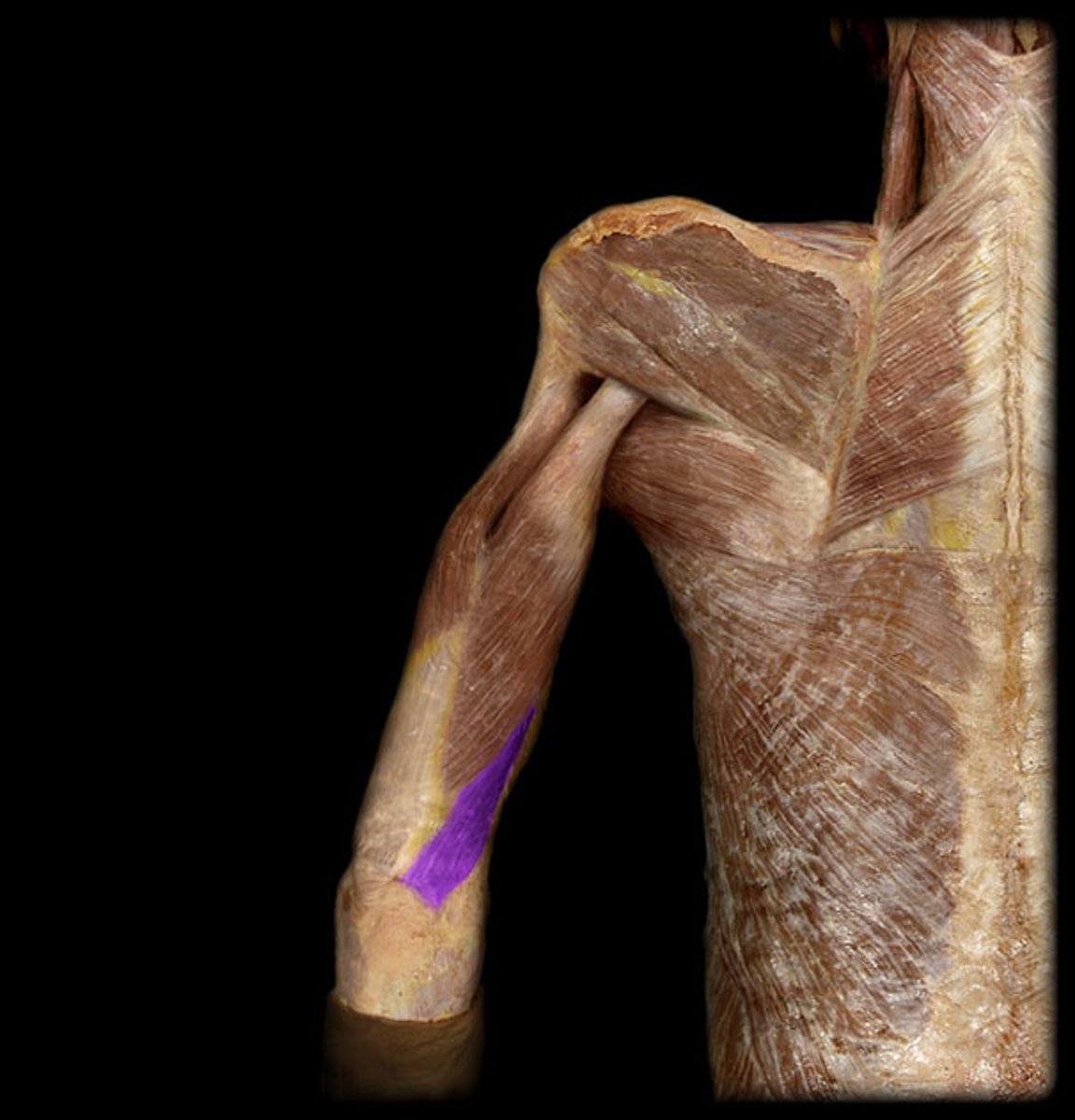 <p>Origin: The posterior surface of the humerus</p><p>Insertion: The posterior surface of the olecranon process of the ulna</p>