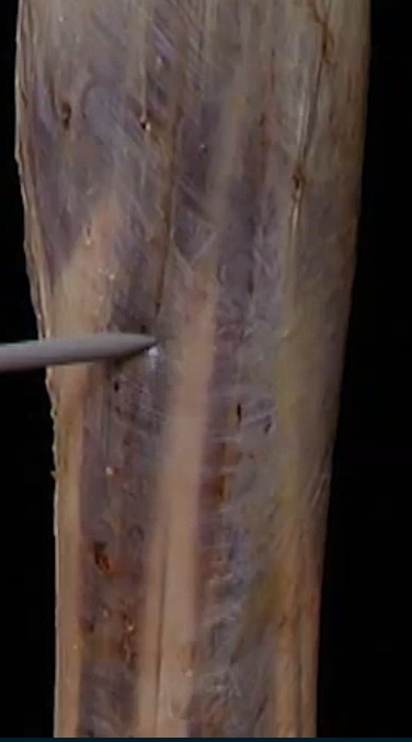 <p>Membraan bovenvoet</p>