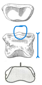 <ul><li><p>broad, shallow and symmetrical</p></li><li><p>ridge, not groove</p></li><li><p>shorter, stubbier</p></li></ul><p></p><p>horse intermediate phalanx</p><p></p>