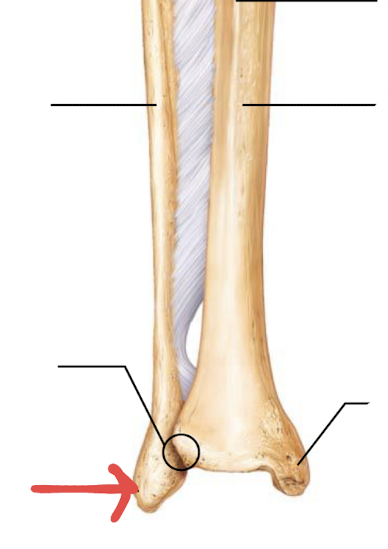 <p>what is this part of the tibia or fibula?</p>