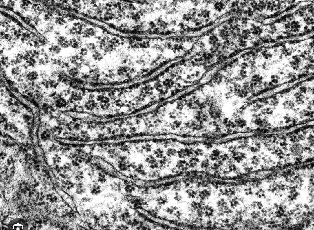 <p>Looks like a series of flattened, interconnected, sheet-like sacs called cisternae that are studded with tiny, dark, granular dots representing ribosomes</p>
